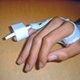 Illustration Appareillage sur rupture des tendons extenseurs